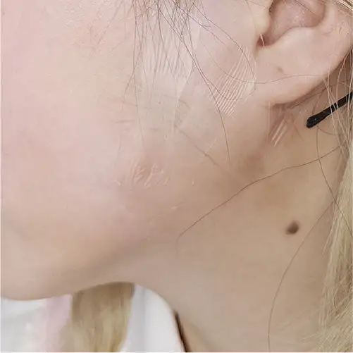 UNIQSO Face Lifting Tape - Image 5